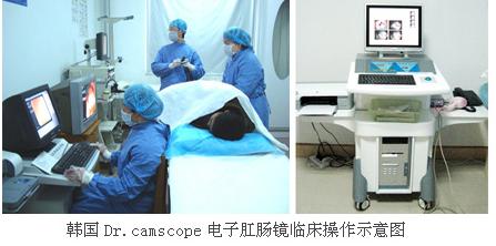 肛瘘是怎么回事